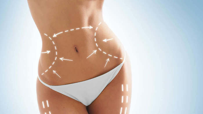 ¿Sabes qué es la lipolisis laser?