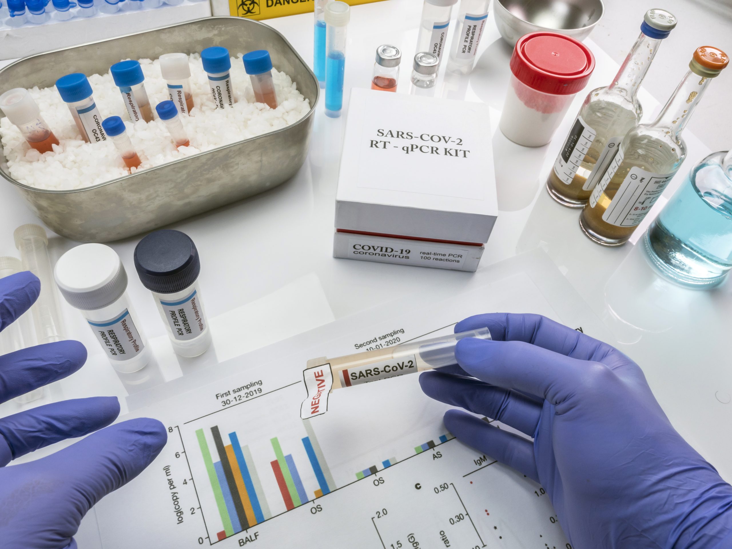 Termociclador para PCR: tipos y aplicaciones.