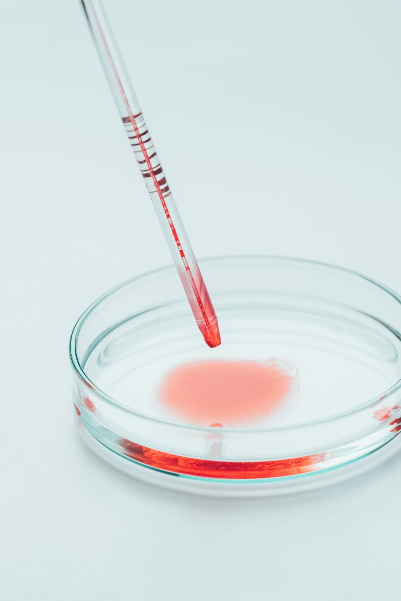 Estudio de Brotes y Transmisión de Enfermedades Utilizando Reactivos Sanguíneos